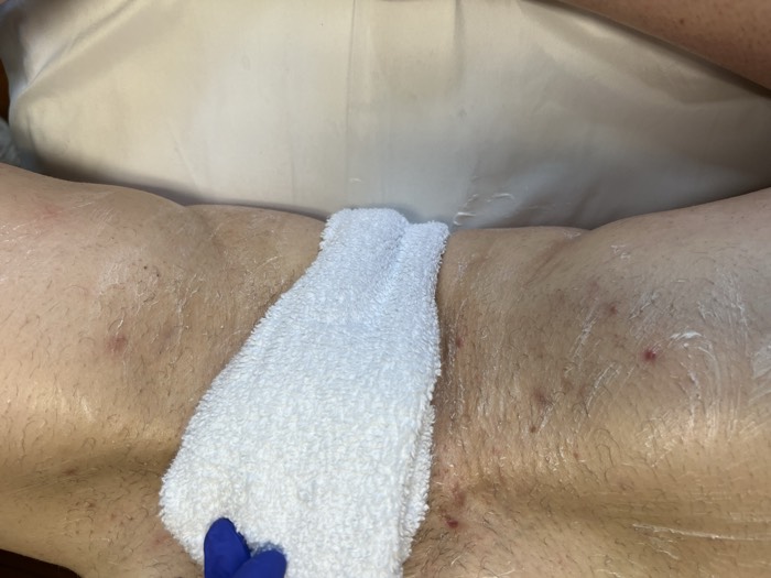 Bikini Waxing at Aesthetics by Vero in Everett, MA