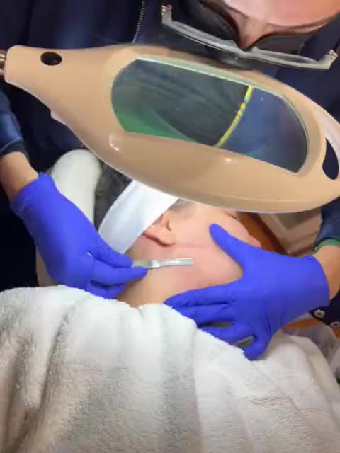 Dermaplaning at Aesthetics by Vero in Everett, MA