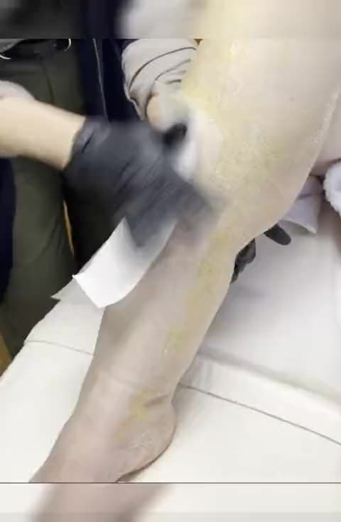 Full Legs Waxing at Aesthetics by Vero in Everett, MA